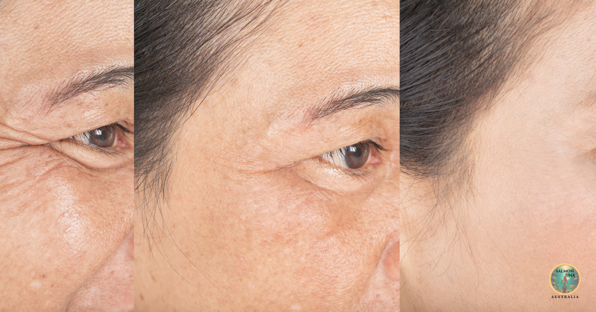 Close-up of skin showing improvements in texture and elasticity using Salmon DNA Serum Daily Skinbooster.