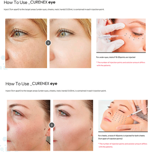 Close-up images illustrating the application process of Curenex Eye PN using microneedling techniques on the face.